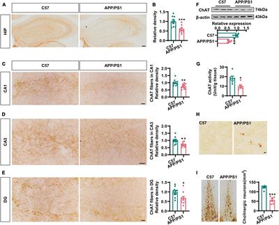 Elevated Levels of miR-144-3p Induce Cholinergic Degeneration by Impairing the Maturation of NGF in Alzheimer’s Disease